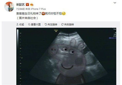 张歆艺晒b超照宣布怀孕为袁弘庆生 网友:果然嫁对人