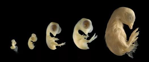 小康康寄生胎_印度一女婴体内有8个寄生胎_寄生胎图片一