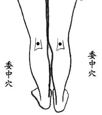 医生用这个独家秘方,治好了自己父亲的老寒腿!
