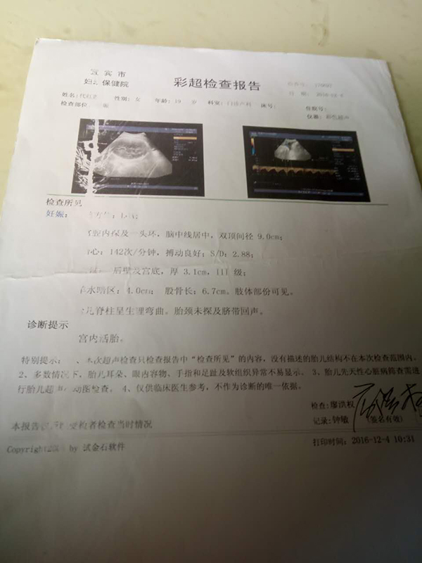 彩超检查报告中,并未明示形体发育情况